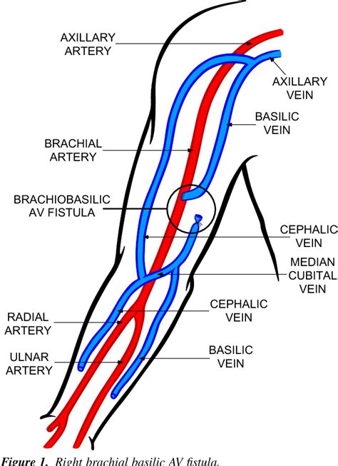 Figure From Axillary Artery Brachial Artery Radial Artery Ulnar