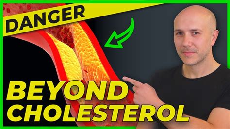 Triglycerides Over The Charts And You Don T Know It Cholesterol