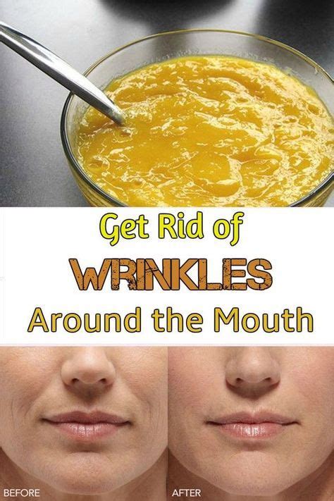 Get Rid Of Wrinkles Around The Mouth Anti Aging Homemade Homemade
