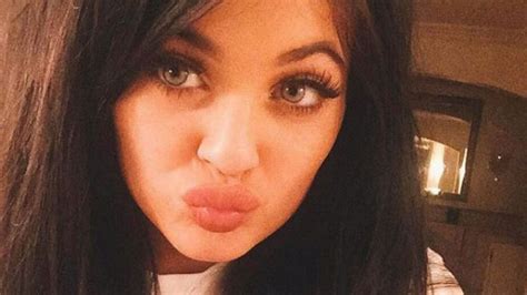 Babe Girls Urged Not To Copy Kylie Jenner S Legendary Pout By Top Cosmetic Surgeon Mirror