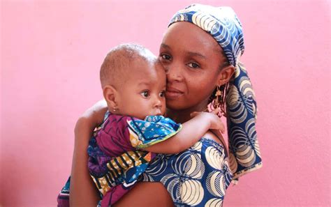 Mortalité Maternelle 20 Femmes Décèdent Chaque Jour Au Cameroun