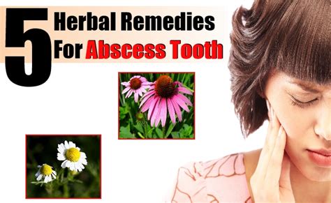 5 Best Herbal Remedies For Abscess Tooth Natural Home Remedies