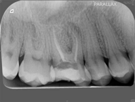 Endodontics Clinic 334