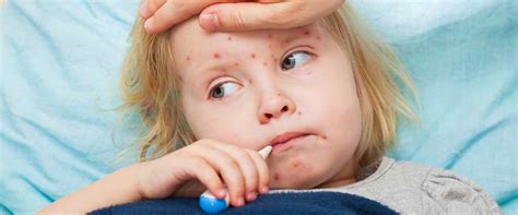 Bebeklerde Viral Enfeksiyon Nedir Neden Olur Ve Belirtileri Nelerdir