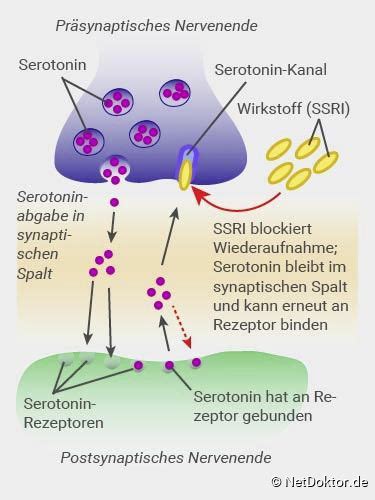 Ssri steht als abkürzung für selektive serotonin reuptake inhibitoren. Depression: Symptome, Behandlung, Ursachen - NetDoktor