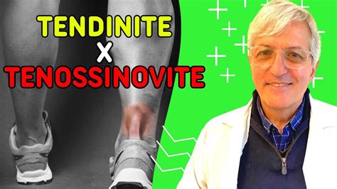 Diferenças entre tendinite e tenossinovite Dr Fabio Ravaglia YouTube