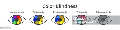 Vector Set Of Icons Or Symbols Of Eyes With Color Blindness Or Colorblindness Isolated On White