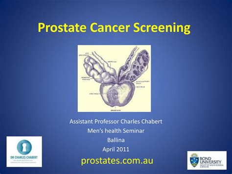 Ppt Prostate Cancer Screening Powerpoint Presentation Free Download Id