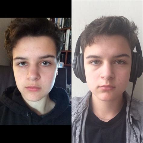 Unsure If My Face Actually Looks Different But Im Finally One Month