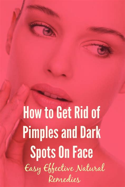 How to remove pimples at home how to get rid of pimples instantly pimple treatments tips on how to prevent pimples. How to Remove Pimple Scars Naturally at Home