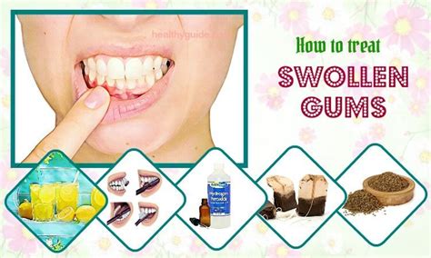 When a cut on gums ruins your day, here are the signs that you should visit a doctor. 34 Tips How to Treat Swollen Gums around Tooth and Cheek Fast