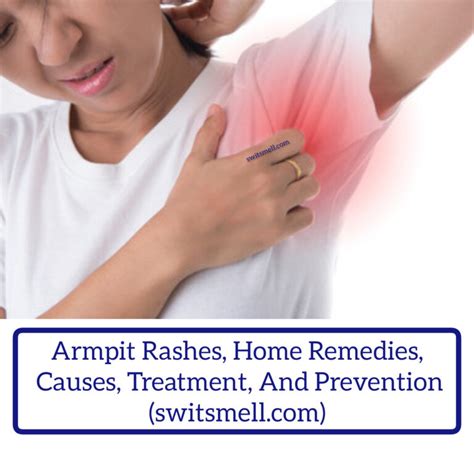 Armpit Rashes Home Remedies Causes Treatment And Prevention
