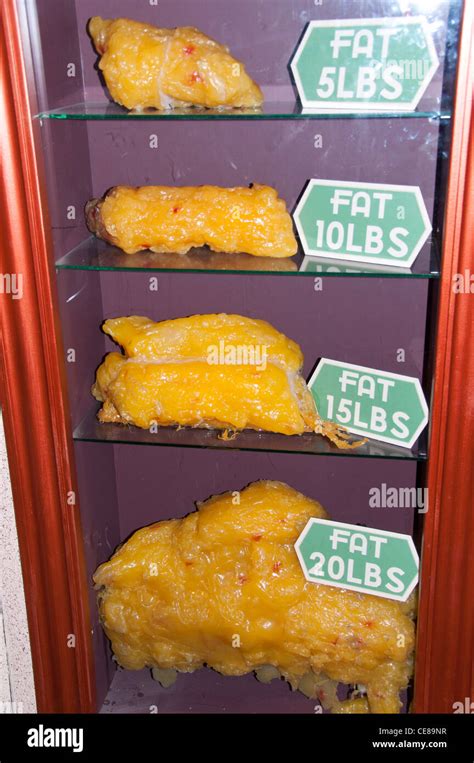 Body Fat Comparison Stock Photo 43209203 Alamy