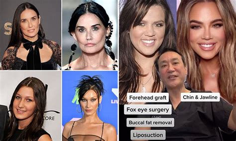 Plastic Surgeon Reveals Which A Listers Have Probably Gone Under The Knife By Analyzing Images