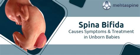 Spina Bifida Causes Symptoms Treatment In Unborn Babies