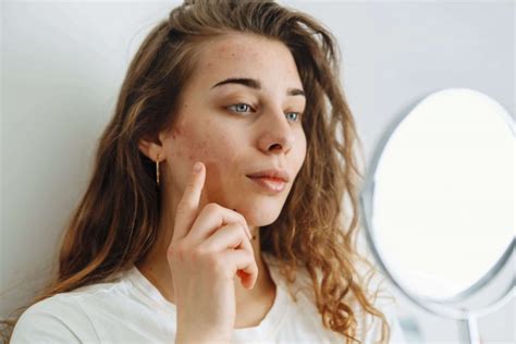 4 Routines Pour Lutter Contre Les Imperfections Du Visage