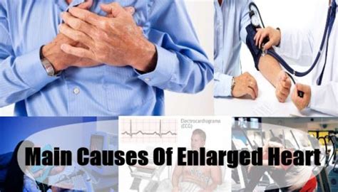 9 Common Symptoms Of Enlarged Heart Enlarged Heart Enlarged Heart
