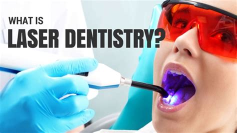 What Is Laser Dentistry Professional Ottawa Downtown Dentist