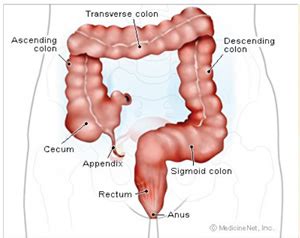 What is Colorectal Cancer - Colorectal Cancer Alliance of Central