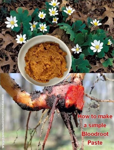 Herbal Recipe Simple Bloodroot Paste People Generally Use This Simple