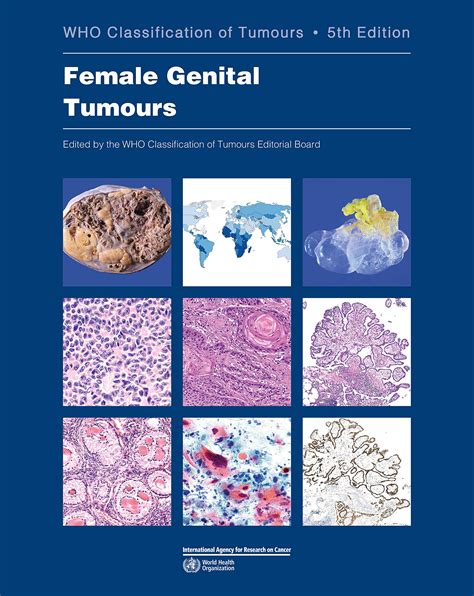Who Classification Of Female Genital Tumours Who Classification Of