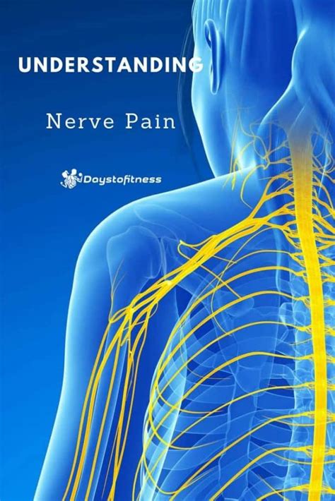 Understanding Nerve Pain Pin Days To Fitness