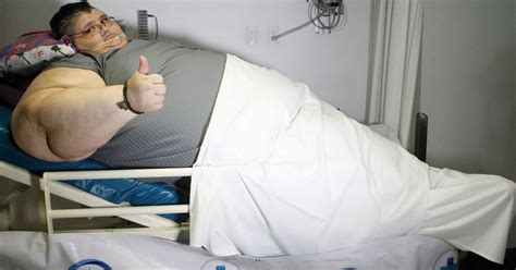 Worlds Fattest Man Hoping To Lose Half His Weight In Special Operation