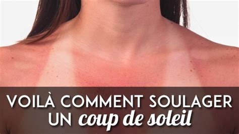 Le coup de soleil est le signe que la peau a été agressée par les rayons soleil lors d'une exposition solaire. Coup De Soleil : news, photos, vidéos