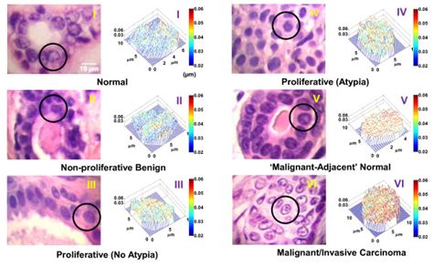 Representative Conventional Images Of Breast Biopsies And Download