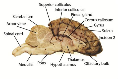 Labeled Diagram Of Sheep Brain