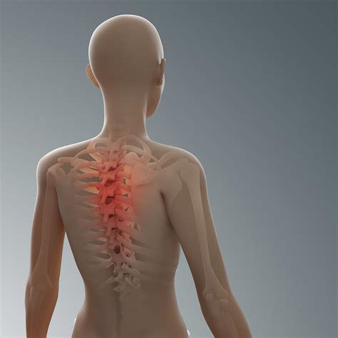 Back Pain Conceptual Artwork Digital Art By Andrzej Wojcicki Pixels