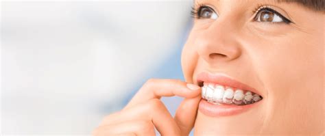 Invisalign Fort Lauderdale Florida Orthodontist Florida Smiles Dental