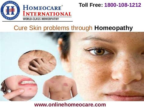 Skin Infections Cured Through Homeopathic Medicine