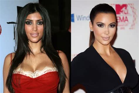 Kim Kardashian Before And After Plastic Surgery Architecture World