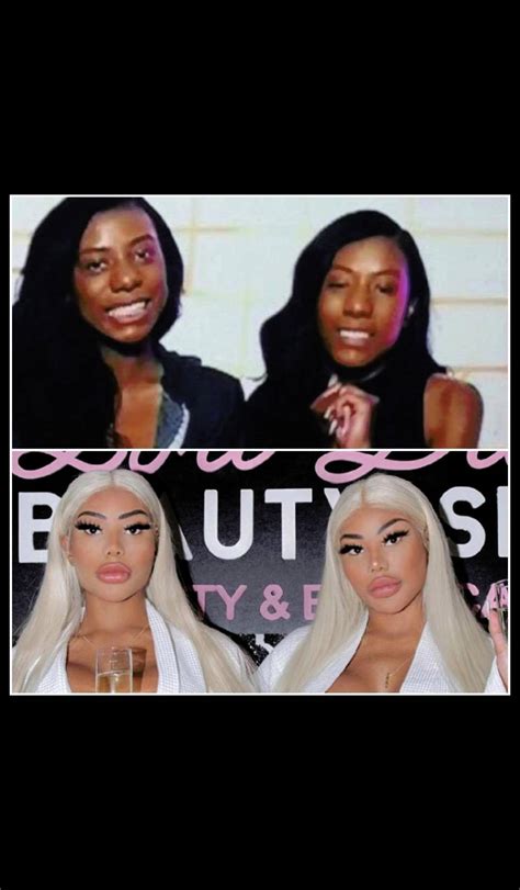 Clermont Twins Before After 🤯 Scrolller