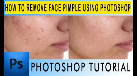 Remove Face Pimple In Photoshop Photoshop Tutorial Make A