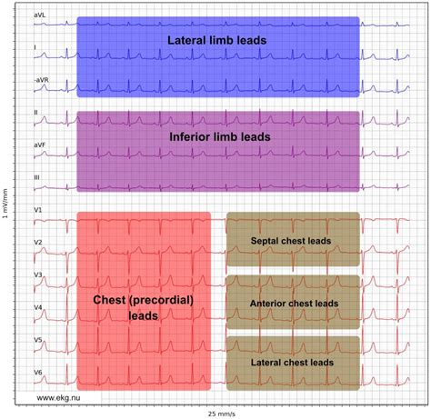 The Ecg Leads Electrodes Limb Leads Chest Precordial Leads And The