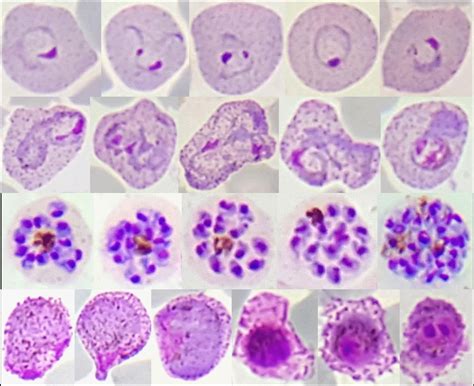 Gene Sequences Reveal Global Variations In Malaria Parasites