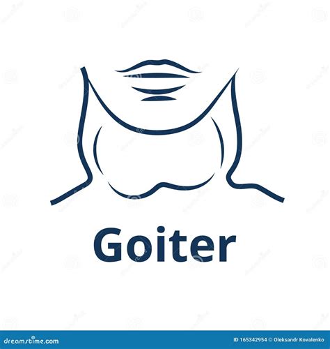 Goiter Icon 甲状腺肿大概念艺术品 向量例证 插画 包括有 疾病 女主持人 线性 图标 165342954