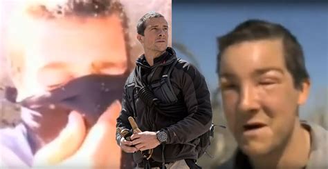 Watch Bear Grylls Rushes For Aid After Savage Allergic Reaction To Bee Sting Extra Ie