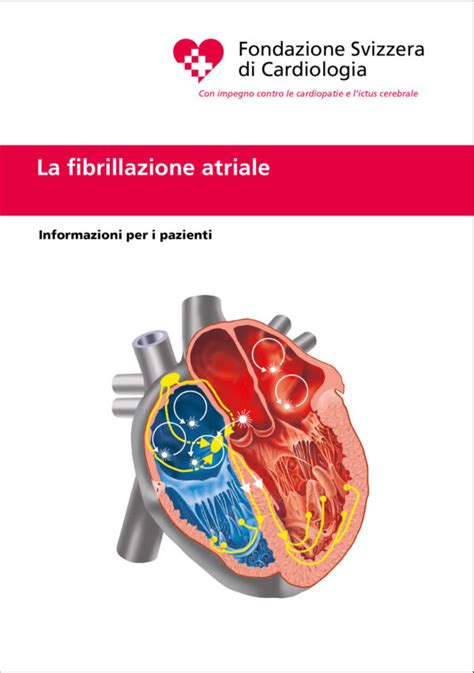 Fibrillazione Atriale Fondazione Svizzera Di Cardiologia