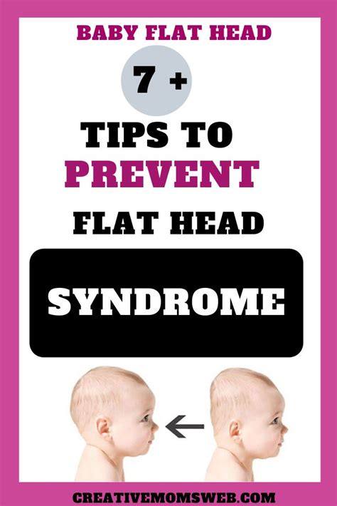 7 Tips To Prevent The Flat Head Syndrome