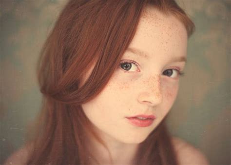 Many Freckles Photo Contest Winners VIEWBUG Com