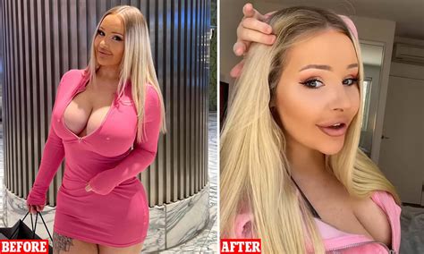 Woman Spends 10000 On Plastic Surgery To Look Like Barbie