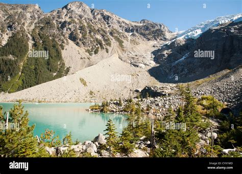 Scenic Upper Joffre Lake An Alpine Lake And Mountainous Terrain