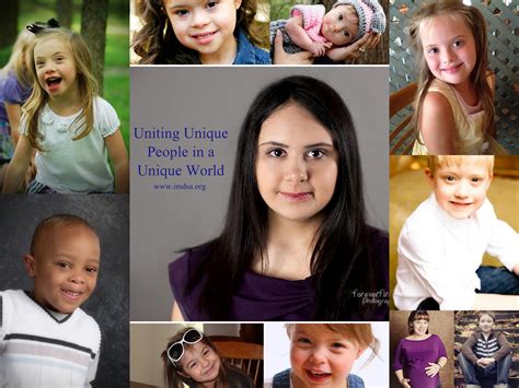 Physical Appearance Mosaic Down Syndrome Celebrities