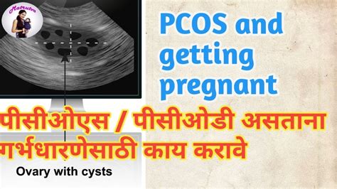 Pcos Pcod And Getting Pregnant Can You Get Pregnant With Pcos पीसीओडी आणि गर्भधारणा Youtube