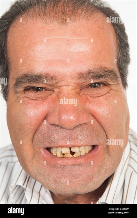 Adult Man Crooked Teeth Hi Res Stock Photography And Images Alamy