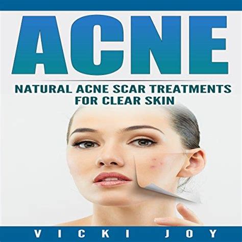 Acne Natural Acne Scar Treatments For Clear Skin Top Acne Products