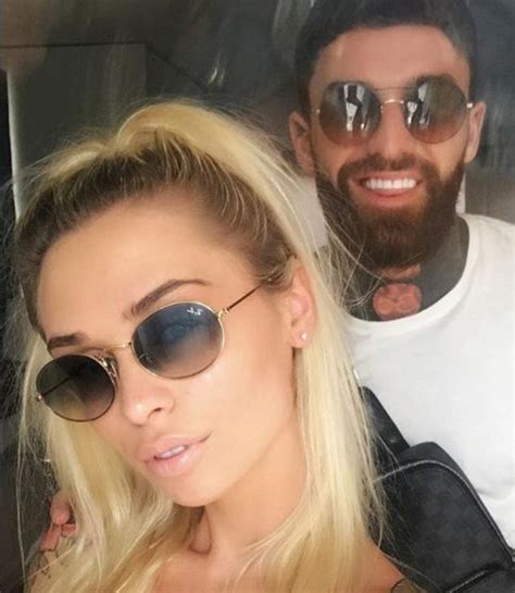 Girlfriend Of Geordie Shores Aaron Chalmers Gave Botched Treatment